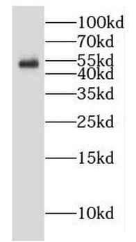 GALNTL5 Rabbit Polyclonal Antibody