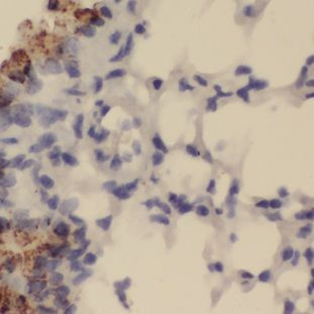 GALNTL5 Rabbit Polyclonal Antibody