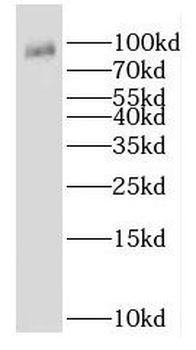 AP1G1 Rabbit Polyclonal Antibody