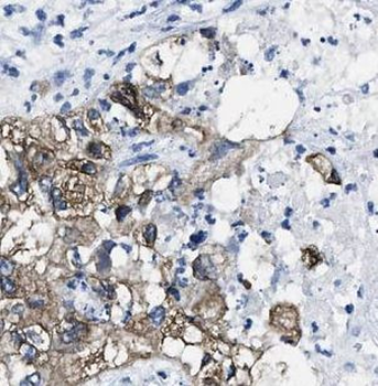 AP1G1 Rabbit Polyclonal Antibody