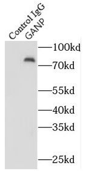 MCM3AP Rabbit Polyclonal Antibody