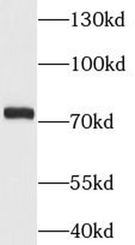 MCM3AP Rabbit Polyclonal Antibody