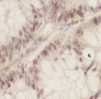 MCM3AP Rabbit Polyclonal Antibody
