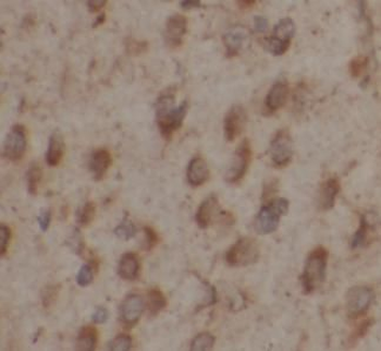 GAP43 Rabbit Polyclonal Antibody
