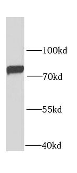 GARS1 Rabbit Polyclonal Antibody