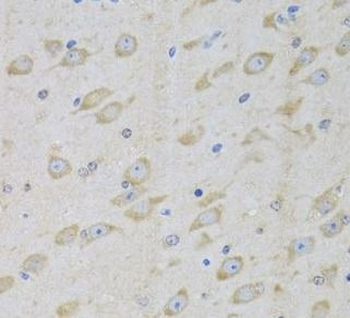 GARS1 Rabbit Polyclonal Antibody