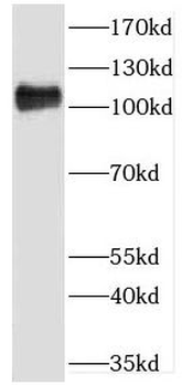 GART Rabbit Polyclonal Antibody