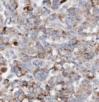GART Rabbit Polyclonal Antibody
