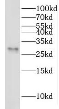 YEATS4 Antibody
