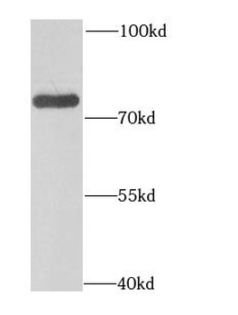 GAS6 Antibody
