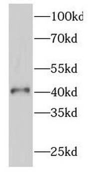 GATA5 Rabbit Polyclonal Antibody