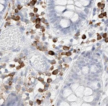 GATA5 Rabbit Polyclonal Antibody