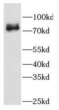 GBE1 Rabbit Polyclonal Antibody