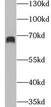 GBP2 Rabbit Polyclonal Antibody