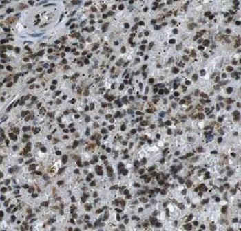 GBP2 Rabbit Polyclonal Antibody