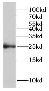 GCSAM Rabbit Polyclonal Antibody