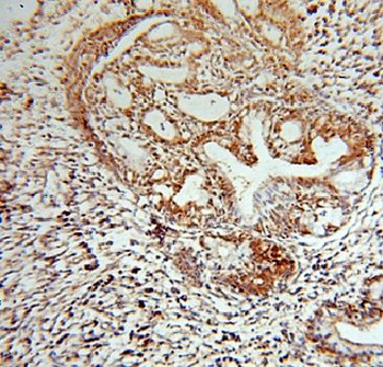 GCHFR Rabbit Polyclonal Antibody