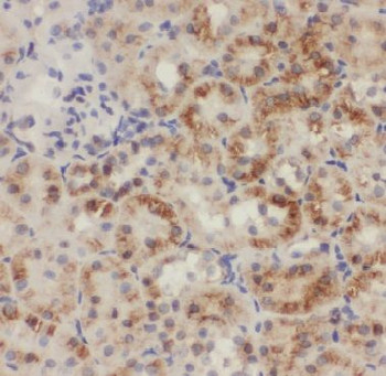 GCLC Rabbit Polyclonal Antibody