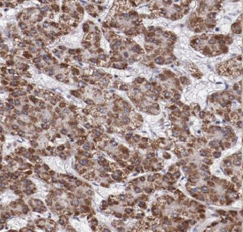 GCLM Rabbit Polyclonal Antibody