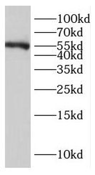 NR6A1 Rabbit Polyclonal Antibody