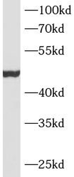 MSTN Rabbit Polyclonal Antibody