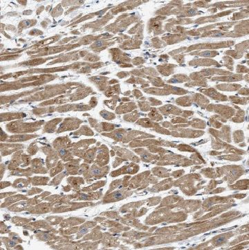 MSTN Rabbit Polyclonal Antibody