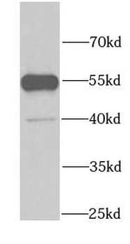 GDI1 Rabbit Polyclonal Antibody