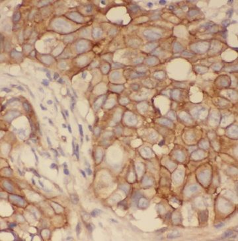 GDI1 Rabbit Polyclonal Antibody