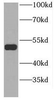 GDI2 Rabbit Polyclonal Antibody