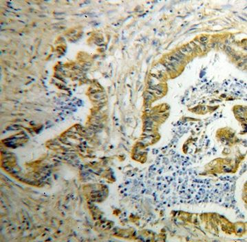 GDI2 Rabbit Polyclonal Antibody