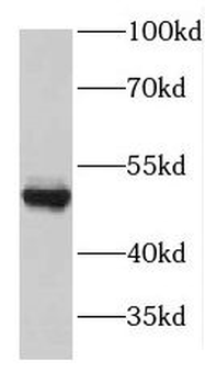 GDI2 Rabbit Polyclonal Antibody