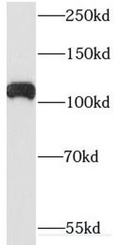 ARHGEF2 Rabbit Polyclonal Antibody