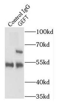 ARHGEF25 Rabbit Polyclonal Antibody