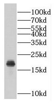 GEMIN6 Rabbit Polyclonal Antibody