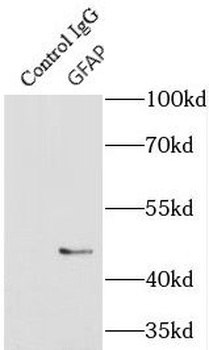 GFAP Antibody