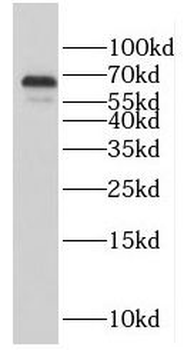 GFI1 Rabbit Polyclonal Antibody