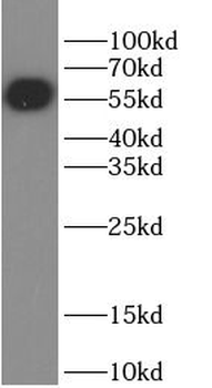 GFP tag Antibody