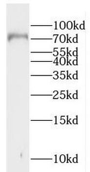 GGA1 Rabbit Polyclonal Antibody