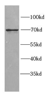 GGA2 Rabbit Polyclonal Antibody