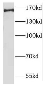 GIGYF2 Rabbit Polyclonal Antibody