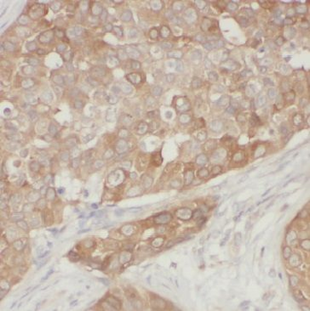GIGYF2 Rabbit Polyclonal Antibody