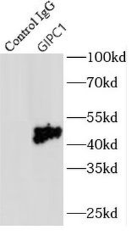 GIPC1 Antibody