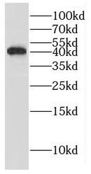 GIPC1 Antibody
