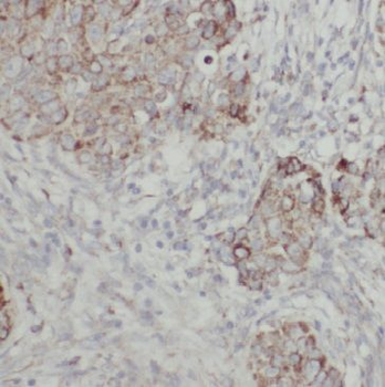 GIPC1 Antibody