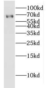 GLIS1 Rabbit Polyclonal Antibody