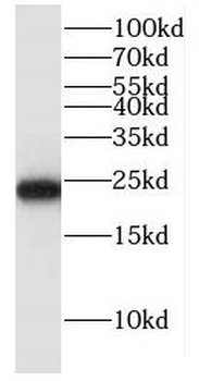 GLO1 Rabbit Polyclonal Antibody