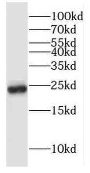 GLO1 Rabbit Polyclonal Antibody
