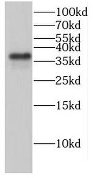 GLRX3 Antibody