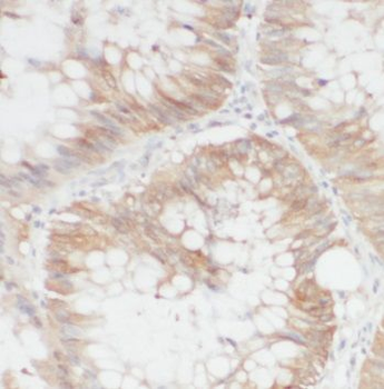 GLRX3 Antibody