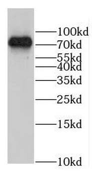 COLGALT1 Rabbit Polyclonal Antibody